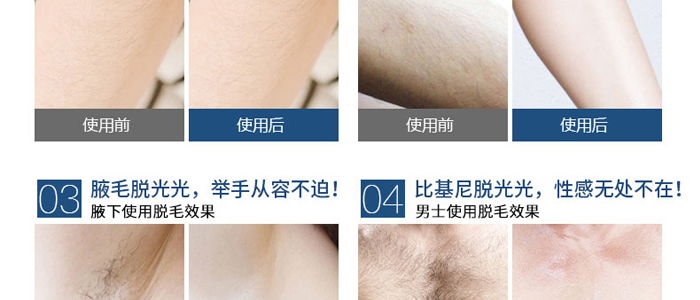 Ԋ(sh��)��Óë��Ϟ