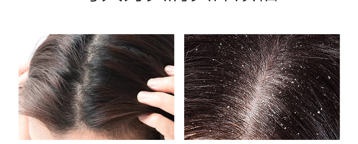 ����ֲ��ȥм����ϴ�l(f��)��