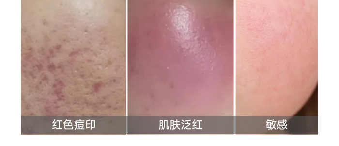 �t(y��)ʩ�����������oҺ